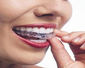 Dentista Milano Gambara De Angeli Gnatologia