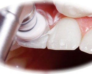 Dentista Milano Gambara De Angeli Igiene E Prevenzione