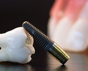 Dentista Milano Gambara De Angeli Implantologia